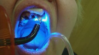 Полость рта как экологическая ниша для микробной флоры полость рта